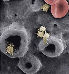 implante dental biomaterial